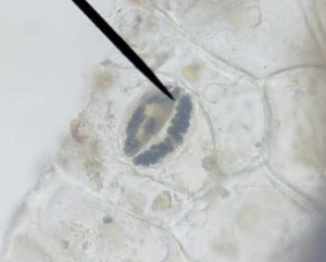 Stomates de plante araignée colorés à l'eau iodée - les chloroplastes apparaissent très nettement bleu/noir en raison de la présence d'amidon